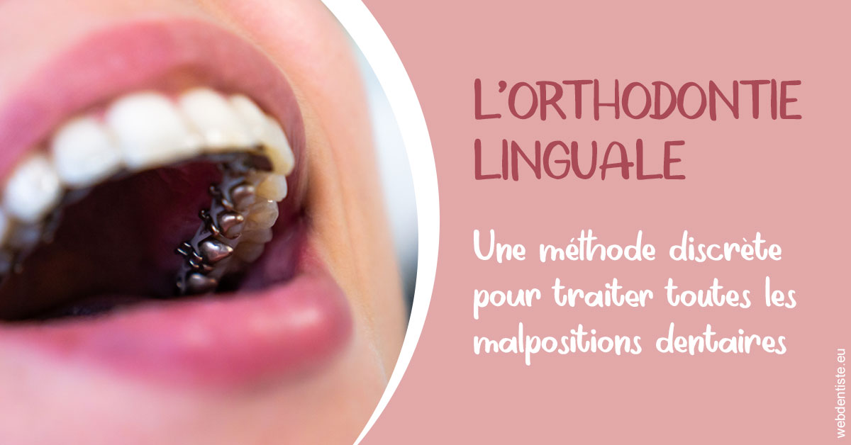https://docteur-didier-colson.chirurgiens-dentistes.fr/L'orthodontie linguale 2