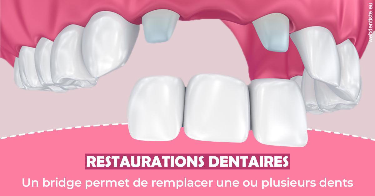 https://docteur-didier-colson.chirurgiens-dentistes.fr/Bridge remplacer dents 2