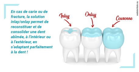https://docteur-didier-colson.chirurgiens-dentistes.fr/L'INLAY ou l'ONLAY