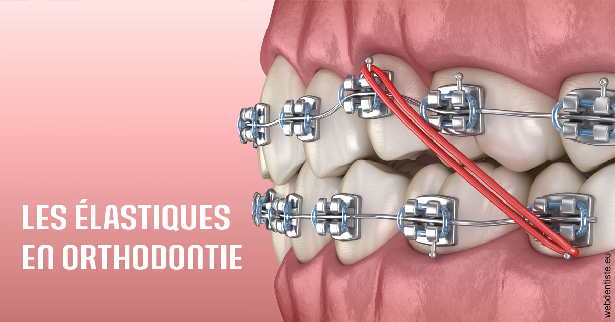 https://docteur-didier-colson.chirurgiens-dentistes.fr/Elastiques orthodontie 2