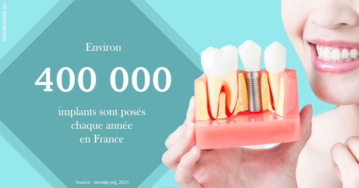 https://docteur-didier-colson.chirurgiens-dentistes.fr/Pose d'implants en France 2